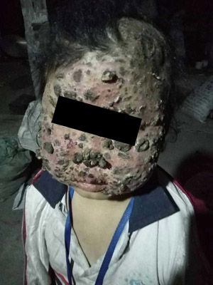 ��Ƥ��������ҽԺ