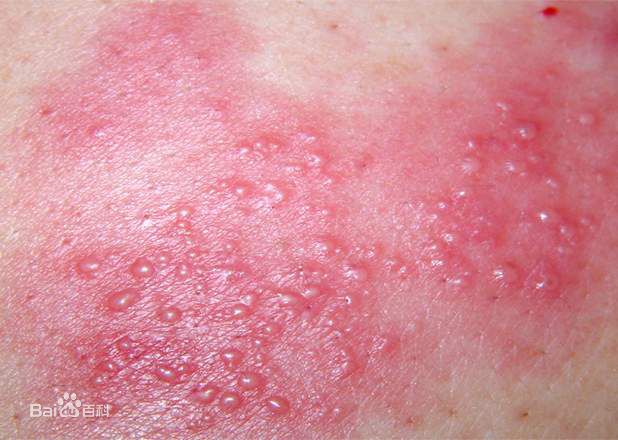 ��״����