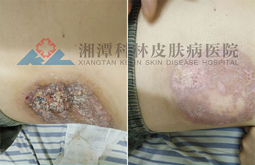 ���ƴ�״����һ�ܶԱ�ͼ