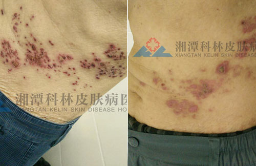 ��Ժ����������״����һ�ܰ���