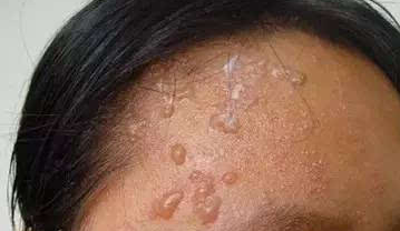 �沿��״������ʲô֢״��