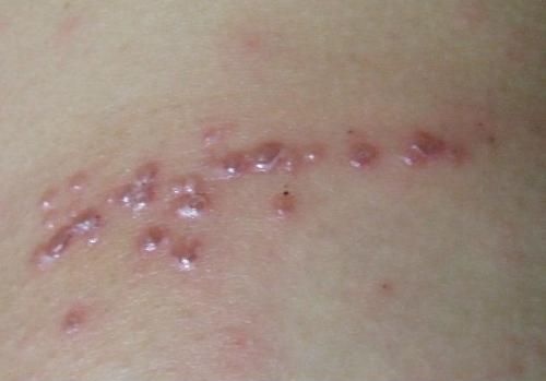 ��������״����